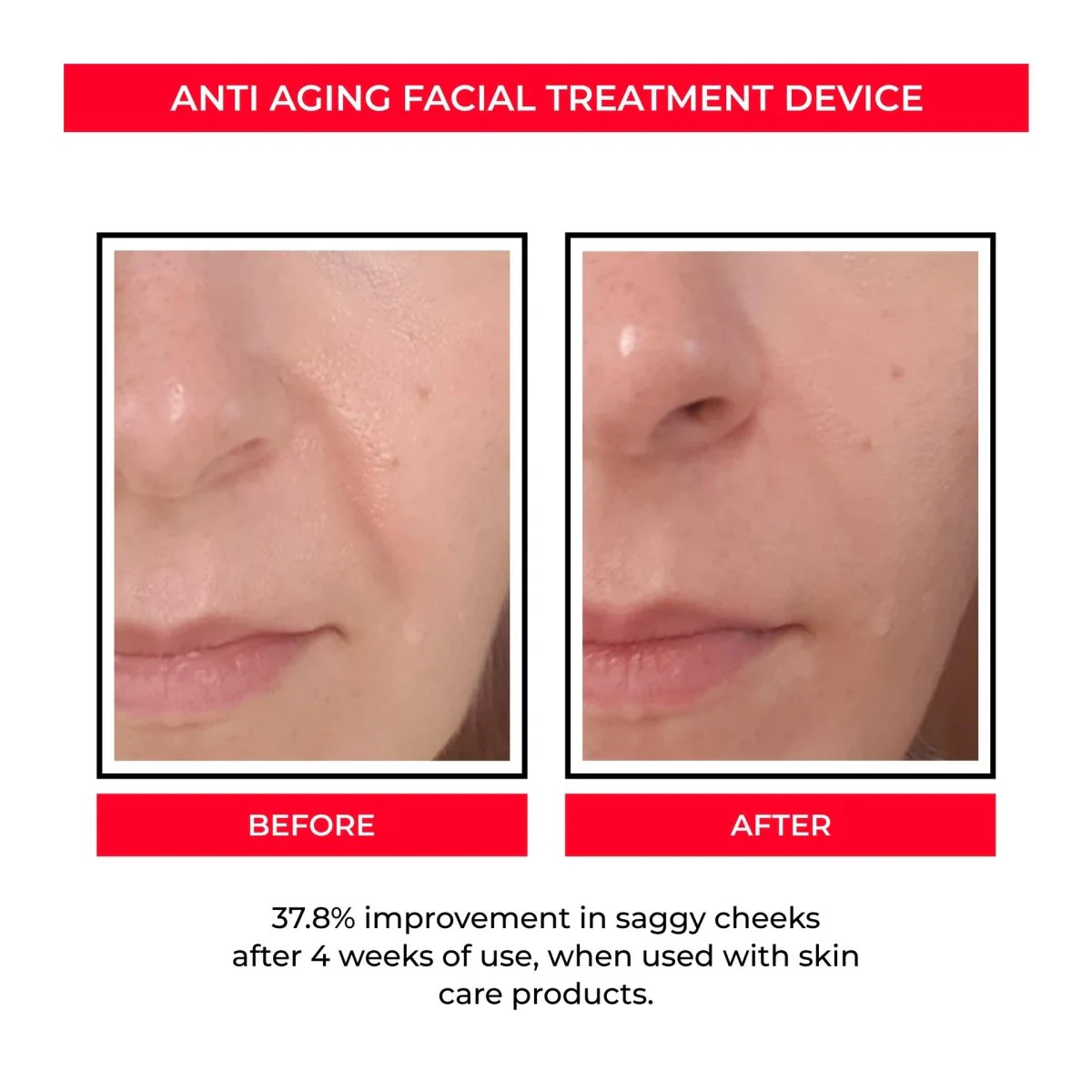 ANTI AGING SKIN-R BOOSTER PRO - Image 3
